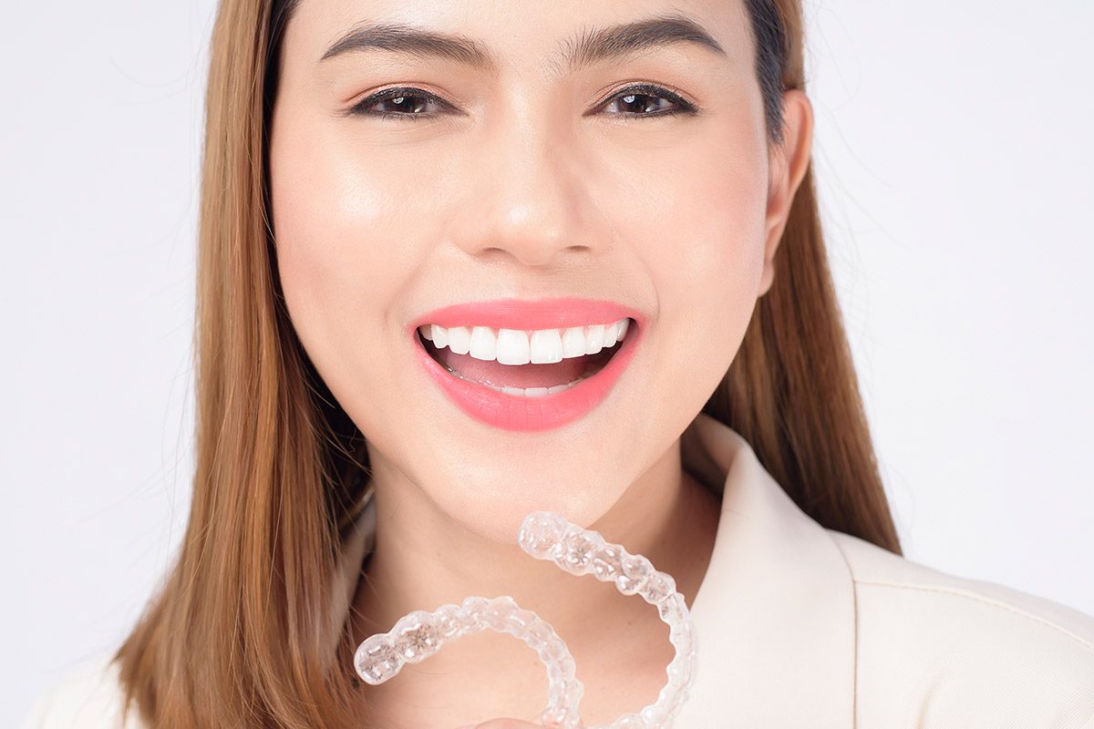 The Convenience of Clear Aligners