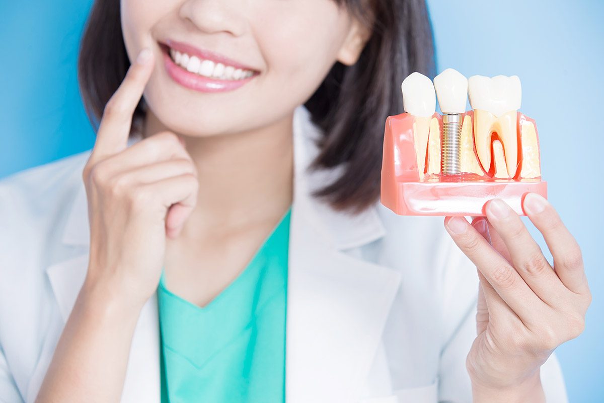 Santa Rosa Dental Implant Recovery Process