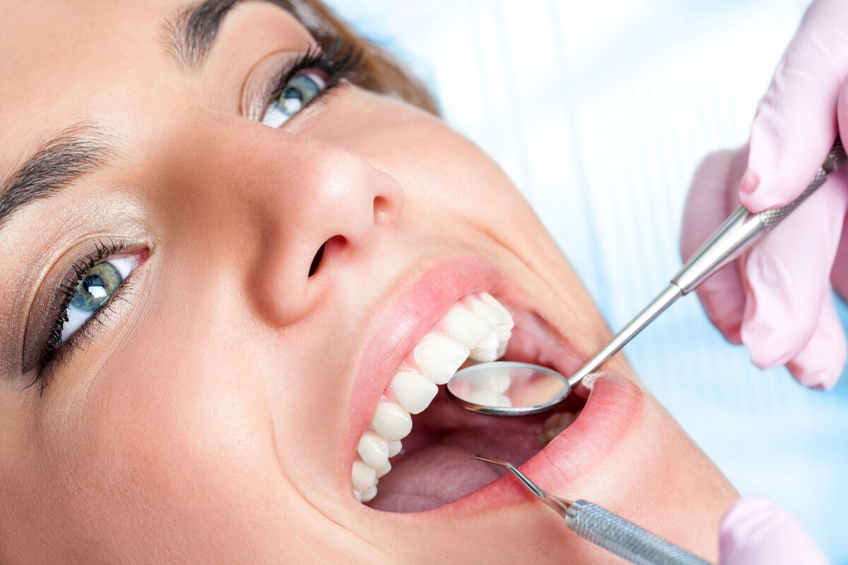 KoR Teeth Whitening by Skilled Dentist in Santa Rosa, CA area